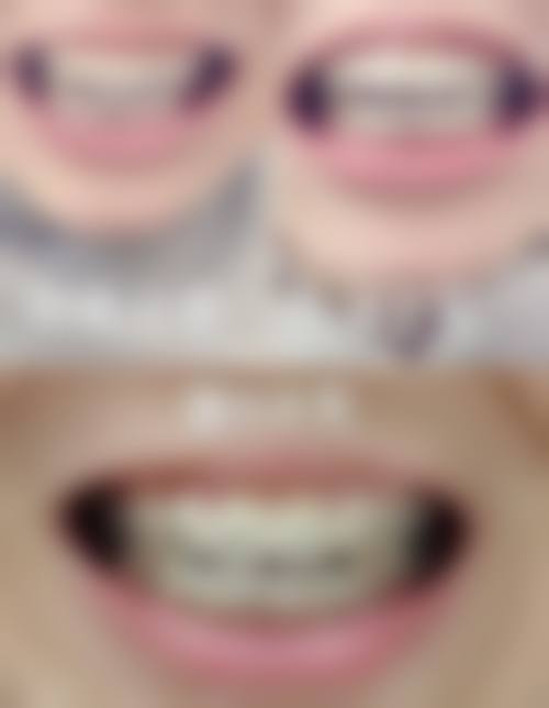 【泰安永强口腔是正规的吗?】