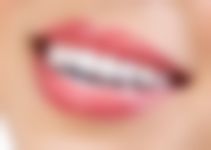 【泰安永强口腔患者口碑评价:】