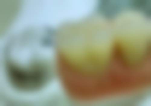 口腔颌面外科拔牙相关知识