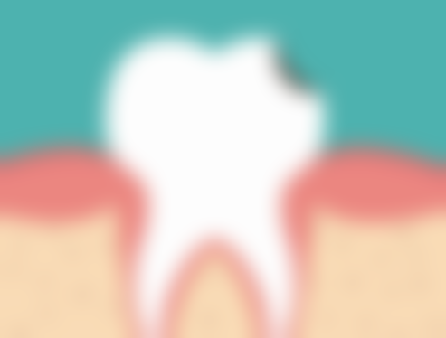 国内医疗保险局种植牙医疗服务价格全流程调控目标为一颗牙4500元