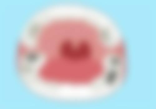 40岁地包天正颌手术要点