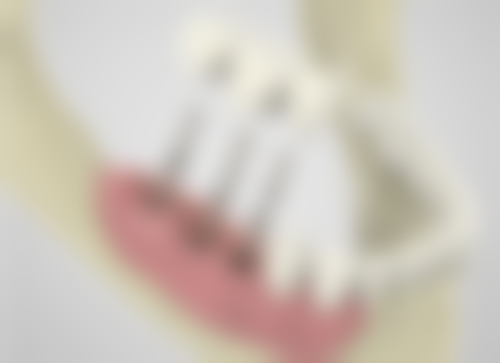 【赵立新医生擅长项目:】