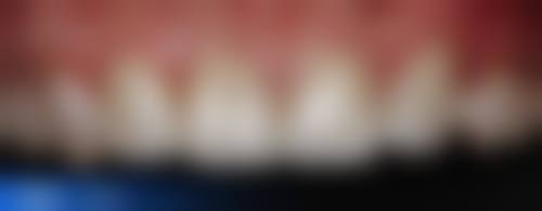 【江忠蔓医生怎么预约挂号?】