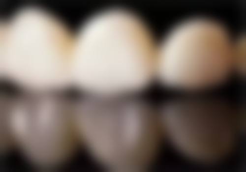 【秦皇岛奥莱口腔诊所参考价格表:】