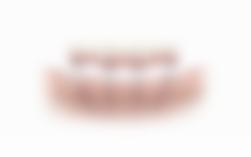 【王玥医生技术特点】