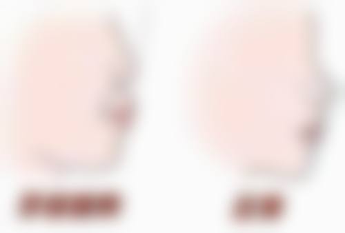 补牙还可以做矫正吗？答案是肯定的！了解补牙后矫正的3大优势，让你牙齿重焕健康光彩！ 