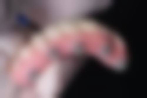 牙性或轻度骨性错合畸形的矫治目的