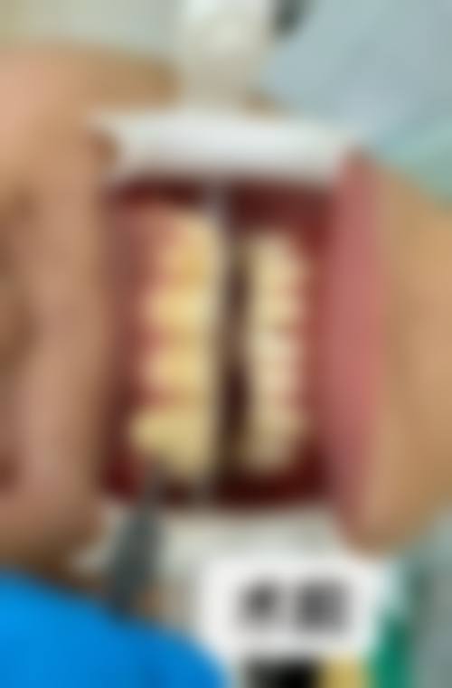 【无锡新东口腔诊所参考价格表：】