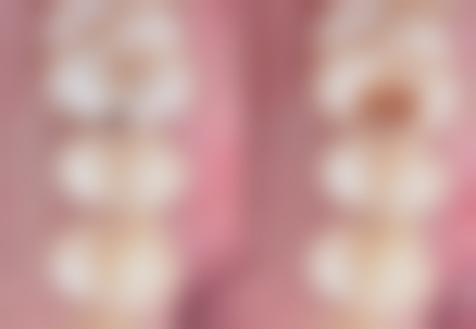 【焦珊医生怎么预约挂号？】