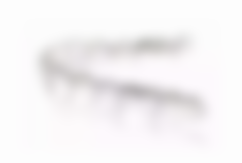 为什么会老掉牙 主要病因是什么 有哪些预防方法