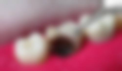 【李天博医生怎么预约挂号？】