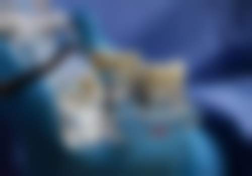 【苏冬云医生技术特点】