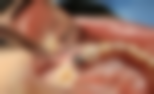 【苏冬云医生擅长项目】