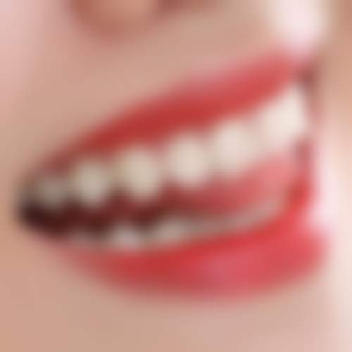 【营口翠微口腔诊所特色项目：】