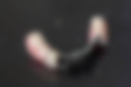 【毕节黔西诚美口腔诊所参考价格表：】