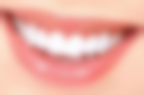 种植牙的国内和品牌