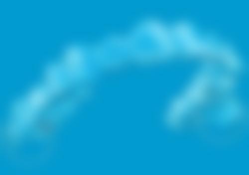 地包天要怎么矫正