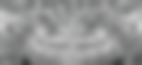 地包天矫正一般费用是多少