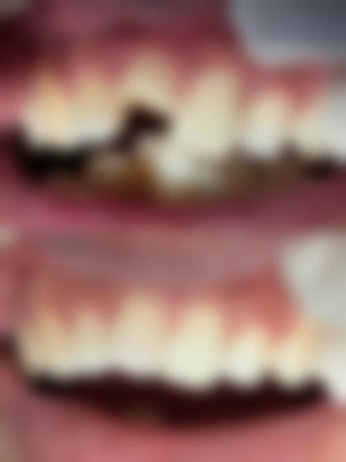 【闫阔医生擅长项目】