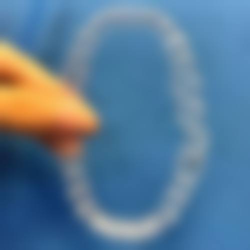 深入了解儿童牙齿根管治疗