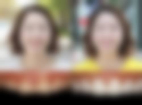 【六安竹子口腔医院是正规的吗?】