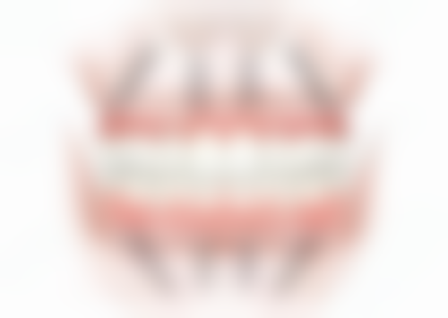 【王桢医生技术特点】