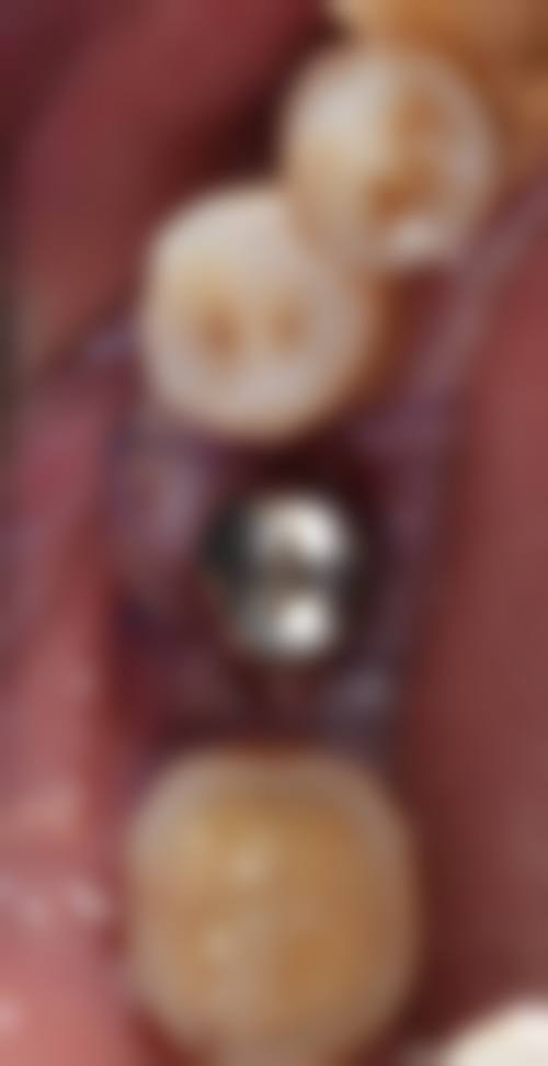 【刘培举医生擅长项目】