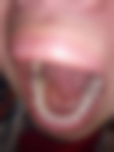 【深圳佳美口腔（罗湖门诊）参考价格表：】