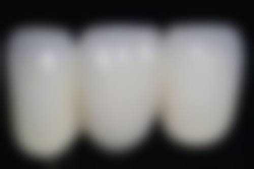 保持良好的生活习惯与饮食习惯