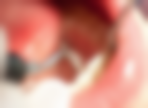 【伍凯医生擅长项目】