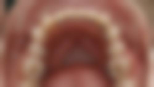 【兰州惠尔安口腔诊所核心优势：】