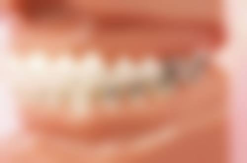 经正畸治疗拔除牙列整齐的除外