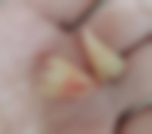 【忻州恒伦口腔门诊是正规的吗?】