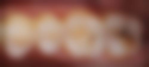 【葛艳医生擅长项目：】