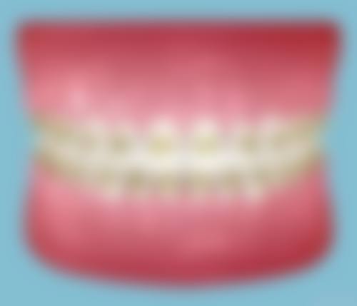 【江西赣州南康新雅口腔特色项目：】