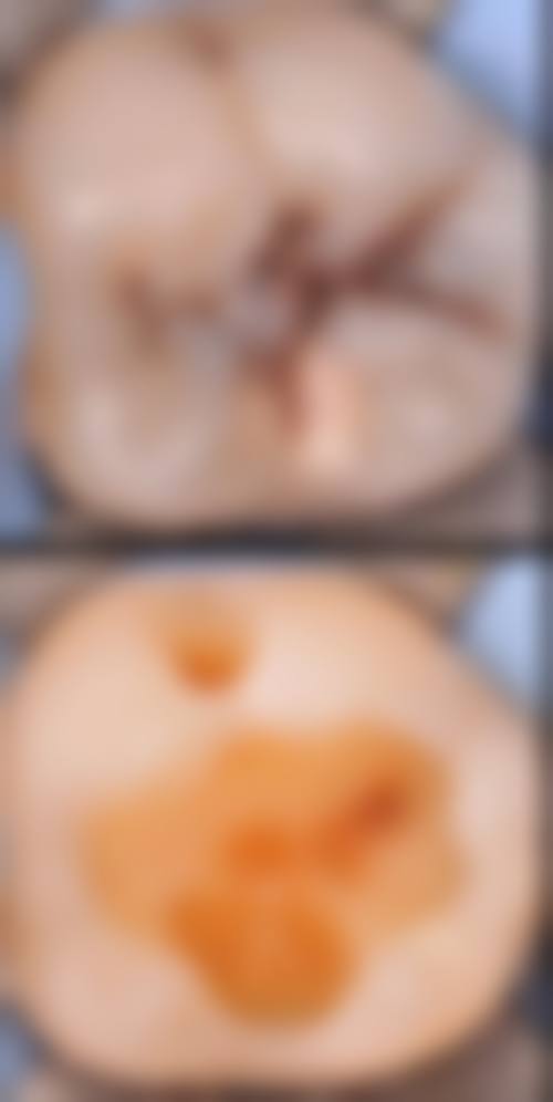 【郝新青医生技术特点：】