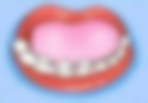 牙齿矫正有风险吗？知乎上怎么说？