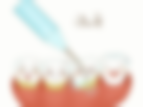 30岁矫正地包天成效明显吗