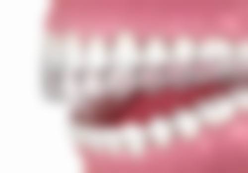 【东莞大朗恒生口腔特色项目：】