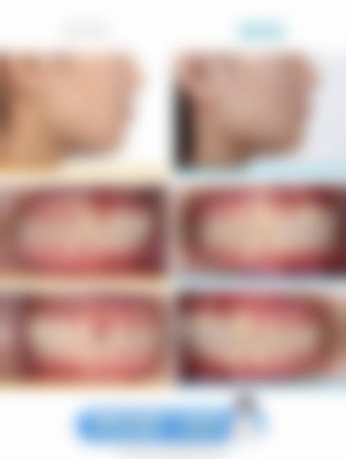 【洛阳孟津河滨口腔诊所患者口碑评价：】