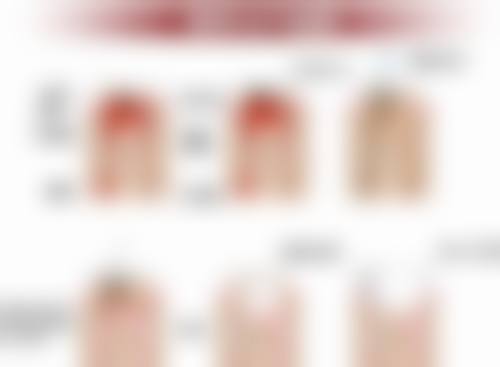 【孙婷婷医生技术特点】