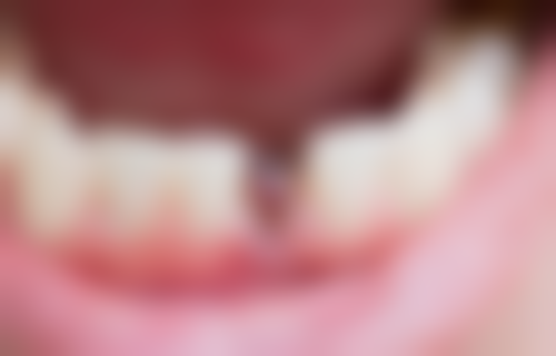 【徐钟镇医生怎么预约挂号？】