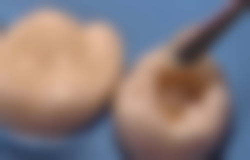 【孙婷婷医生口碑怎么样？】