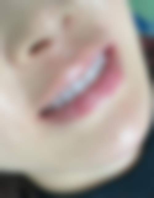 【伍凯医生技术特点】