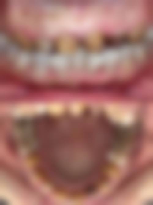 【李晓莺医生口碑怎么样?】