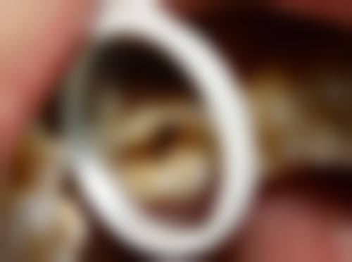 【黄志坚医生技术特点】