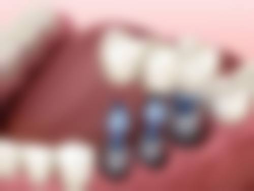 【何绣君医生口碑怎么样?】