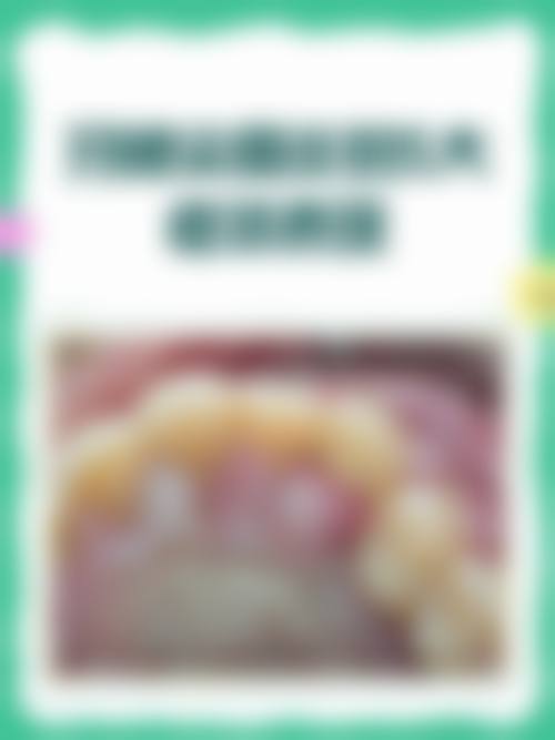 【刘严键医生技术特点】