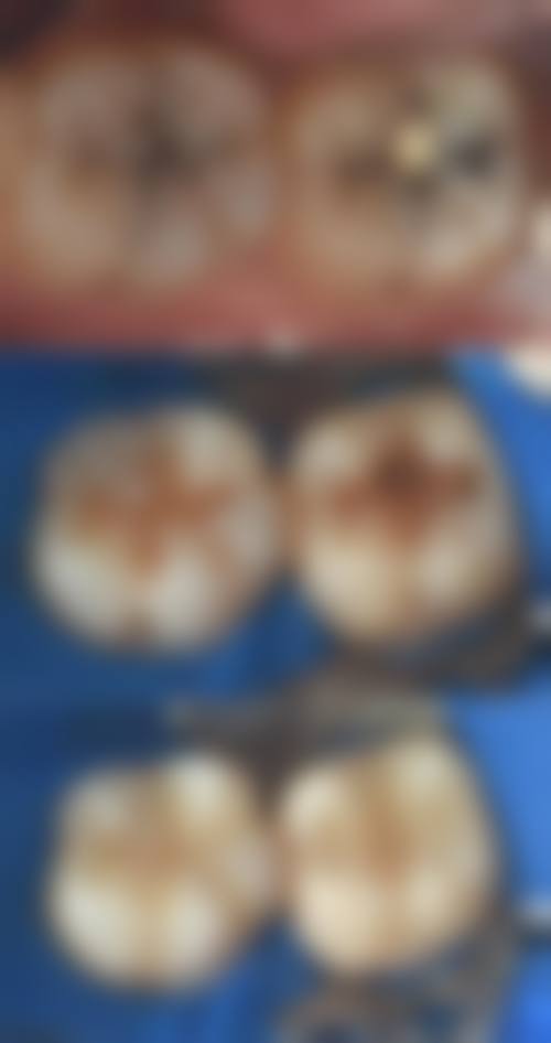 【邹石泉医生技术特点：】