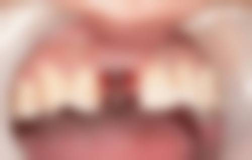 【西 京医院姚青医生擅长项目】